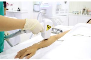 Top 3 Công Nghệ Trị Viêm Nang Lông Ở Lưng Tại Spa Hiệu Quả Nhất